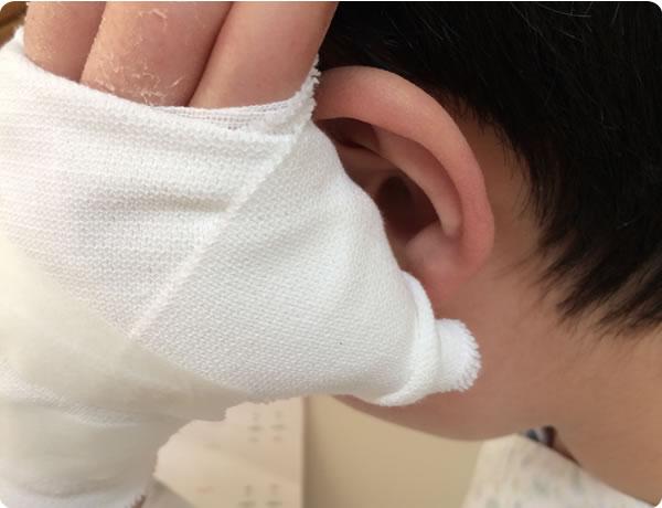 10万人に1人とまれな病気 ホルト・オーラム症候群